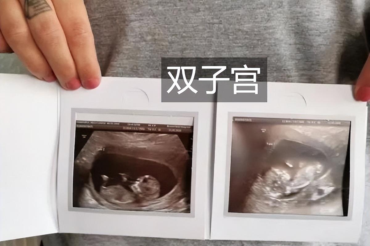 強弱懸殊，難定分界!池上荷花二三片打一准确生肖，详细解答、定量解答解释落实