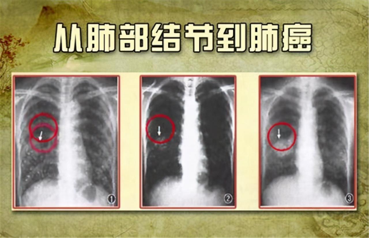 強弱懸殊，難定分界!池上荷花二三片打一准确生肖，详细解答、定量解答解释落实